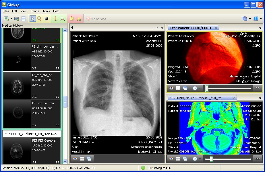 DICOM viewer for Linux