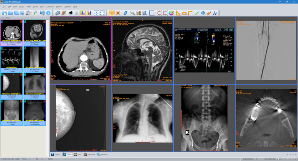 DICOM viewer for Linux