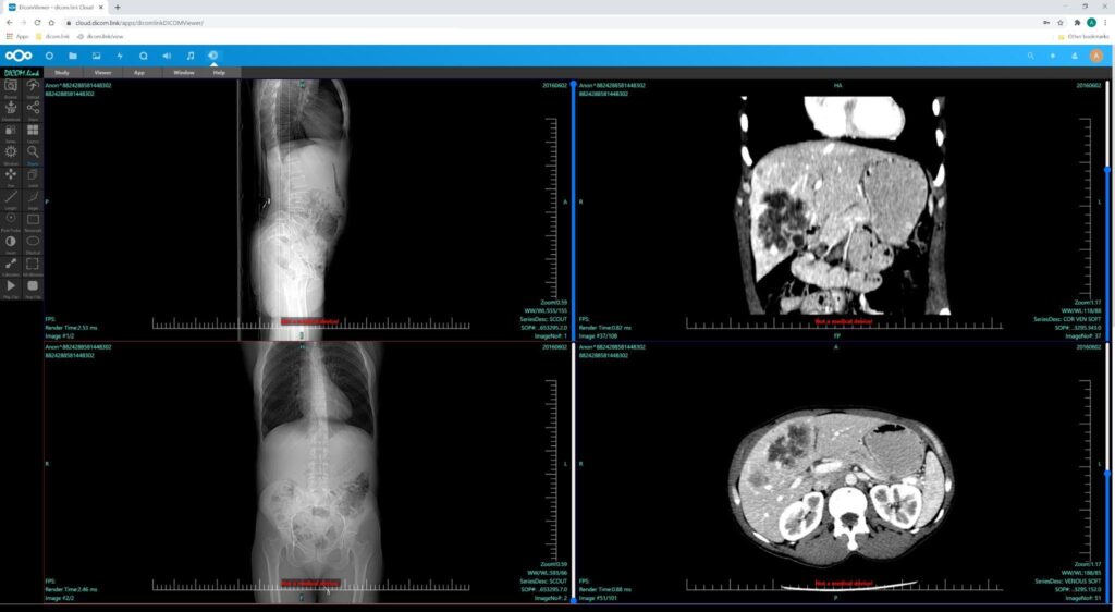 DICOM viewer HTML5